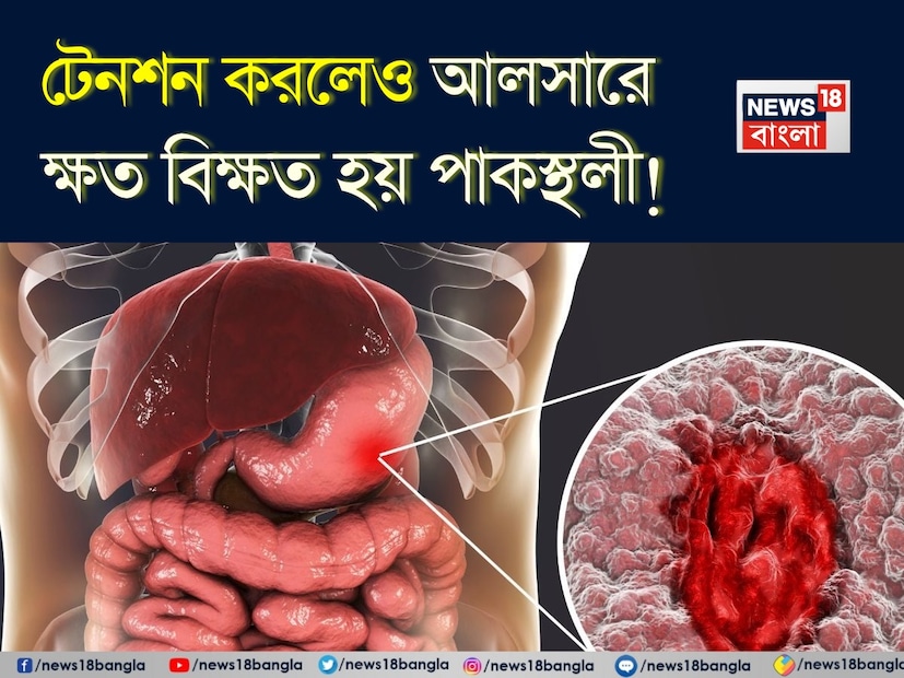 আমাদের বেশিরভাগই পেটের সমস্যাকে খাদ্যে বিষক্রিয়া, মশলাদার খাবার বা সংক্রমণের সঙ্গে জড়িয়ে ফেলে। আমরা খুব কমই ভাবি যে আমাদের মানসিক চাপের মাত্রা, দৈনন্দিন অভ্যাস এবং জীবনযাত্রার পছন্দগুলি নীরবে আমাদের পেটের আস্তরণের ক্ষতি করছে।  আমাদের বেশিরভাগই পেটের সমস্যাকে খাদ্যে বিষক্রিয়া, মশলাদার খাবার বা সংক্রমণের সঙ্গে জড়িয়ে ফেলে। আমরা খুব কমই ভাবি যে আমাদের মানসিক চাপের মাত্রা, দৈনন্দিন অভ্যাস এবং জীবনযাত্রার পছন্দগুলি নীরবে আমাদের পেটের আস্তরণের ক্ষতি করছে।