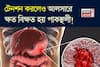 শুধুই নয় মশলাদার খাবার! টেনশনেও হয় পাকস্থলীর আলসার! সতর্ক করলেন বিশেষজ্ঞ ডাক্তার!