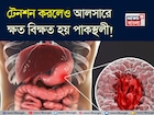 শুধুই নয় মশলাদার খাবার! টেনশনেও হয় পাকস্থলীর আলসার! সতর্ক করলেন বিশেষজ্ঞ ডাক্তার!
