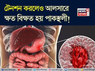 শুধুই নয় মশলাদার খাবার! টেনশনেও হয় পাকস্থলীর আলসার! সতর্ক করলেন বিশেষজ্ঞ ডাক্তার!