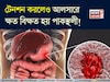শুধুই নয় মশলাদার খাবার! টেনশনেও হয় পাকস্থলীর আলসার! সতর্ক করলেন বিশেষজ্ঞ ডাক্তার!