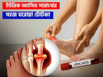 লেবু জল, মেথিদানা, তুলসীপাতা-সহ ৬ জিনিস কীভাবে খেলে উবে যাবে ইউরিক অ্যাসিড, জানুন লেবু জল, মেথিদানা, তুলসীপাতা-সহ ৬ জিনিস কীভাবে খেলে উবে যাবে ইউরিক অ্যাসিড, জানুন
