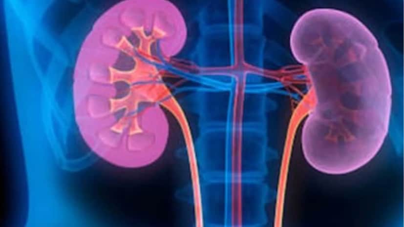 তবে, যদি পাথরটি মূত্রনালীতে আটকে যায় বা এর আকার বড় হয়ে যায়, তবে এটি প্রস্রাবের মাধ্যমে নিজে থেকেই বেরিয়ে আসে না। এটি অপসারণের জন্য অস্ত্রোপচারের প্রয়োজন হয়। আপনি যদি কিডনিতে পাথরের সমস্যায় ভুগছেন এবং পাথরের আকার ৫ মিমি-এর চেয়ে ছোট হয়, তাহলে ডাক্তারের কিছু টিপস অনুসরণ করে, আপনি প্রস্রাবের মাধ্যমে কিডনিতে পাথর দূর করতে পারেন।