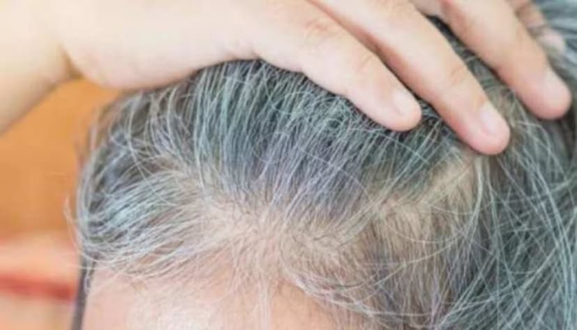 ঘরোয়া টোটকায় খুব কম খরচে কালো হয়ে যায় সাদা চুল৷ তাতে একদিকে টাকা কম লাগে৷ আবার অন্য দিকে চুলেরও ক্ষতি হয় না৷ এরকম একাধিক উপায়ে পাকা চুলের রং করা যায় নিকষ কালো৷