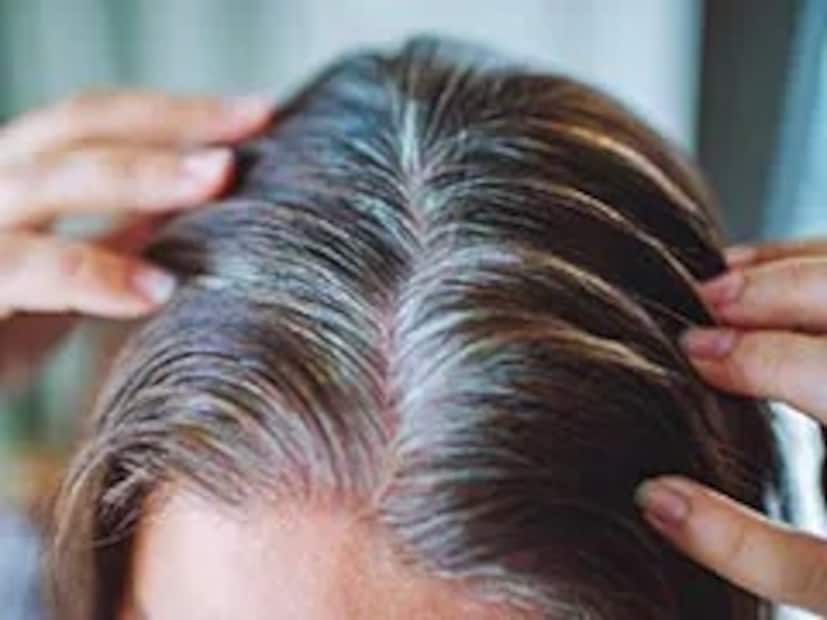 চুল ঘন ও লম্বা হলে পরিমাণ বাড়িয়ে দিন উপকরণগুলির৷ তার পর একই উপায় অনুসরণ করুন৷ কোনও পার্শ্ব প্রতিক্রিয়া ছাড়াই ধবধবে সাদা চুল পাল্টাবে কুচকুচে কালো কেশরাশিতে৷ 