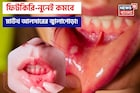 ১ চিমটে ফিটকিরি আর নুনেই কমবে জ্বালাপোড়া! মাউথ আলসারের যন্ত্রণায় চোখে জল আসার দিন শেষ!