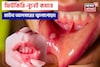 ১ চিমটে ফিটকিরি আর নুনেই কমবে জ্বালাপোড়া! মাউথ আলসারের যন্ত্রণায় চোখে জল আসার দিন শেষ!