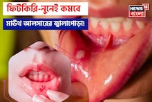Mouth Ulcer Home Remedies: ১ চিমটে ফিটকিরি আর নুনেই কমবে জ্বালাপোড়া! মাউথ আলসারের যন্ত্রণায় চোখে জল আসার দিন শেষ!