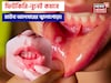১ চিমটে ফিটকিরি আর নুনেই কমবে জ্বালাপোড়া! মাউথ আলসারের যন্ত্রণায় চোখে জল আসার দিন শেষ!