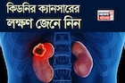 কিডনির ক্যানসারের লক্ষণ কী কী, কখন সতর্ক হবেন, জেনে নিন! বলছেন বিশেষজ্ঞ চিকিৎসক
