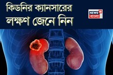 Kidney Cancer Symptoms: কিডনির ক্যানসারের লক্ষণ কী কী, কখন সতর্ক হবেন, জেনে নিন! বলছেন বিশেষজ্ঞ চিকিৎসক