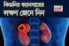 কিডনির ক্যানসারের লক্ষণ কী কী, কখন সতর্ক হবেন, জেনে নিন! বলছেন বিশেষজ্ঞ চিকিৎসক