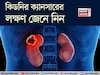 কিডনির ক্যানসারের লক্ষণ কী কী, কখন সতর্ক হবেন, জেনে নিন! বলছেন বিশেষজ্ঞ চিকিৎসক