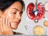 ত্বক ফর্সাকারী ক্রিমে কিডনির বড় ক্ষতি! স্নায়ুতন্ত্রের কার্যকারিতা কমায়, নষ্ট করে লিভার