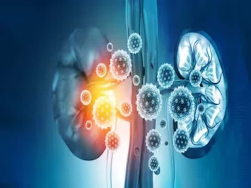 কিডনি ক্যানসার সাধারণত অন্য সমস্যার জন্য পেটের (পেটের) ইমেজিং পরীক্ষার সময় কাকতালীয়ভাবে পাওয়া যায়। কিডনি কোষগুলি কেন পরিবর্তিত হয় এবং ম্যালিগন্যান্ট হয়ে ওঠে তার কারণ অজানা। 