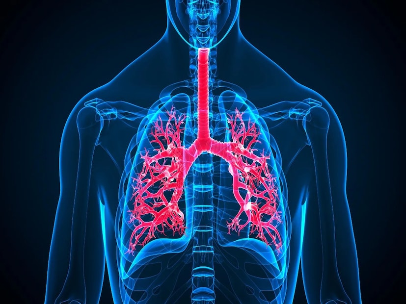 যদি আপনি সকালে অস্বাভাবিক ক্লান্ত বোধ করে ঘুম থেকে উঠেন অথবা শ্বাস নিতে কষ্ট করেন, তাহলে এর জন্য কম ঘুম, মানসিক চাপ বা ব্যায়ামের অভাবকে দোষ দেওয়া সহজ। তবে বিশেষজ্ঞরা সতর্ক করে দিয়েছেন যে এই সূক্ষ্ম লক্ষণগুলি আপনার শরীরের ফুসফুসের স্বাস্থ্যের সঙ্গে আরও গভীর সমস্যাগুলিকে চিহ্নিত করার উপায় হতে পারে। কিছু ক্ষেত্রে, এগুলি ফুসফুসের ক্যানসারের প্রাথমিক লক্ষণগুলির মধ্যেও হতে পারে - এই রোগটি ক্রমবর্ধমানভাবে এমন লোকদের মধ্যে নির্ণয় করা হচ্ছে যারা কখনও ধূমপান করেননি।