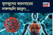 ফুসফুসের ক্যানসারের লক্ষণ কী কী, কাদের হওয়ার ভয় বেশি, জানুন! বলছেন বিশেষজ্ঞ চিকিৎসক