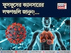 ফুসফুসের ক্যানসারের লক্ষণ কী কী, কাদের হওয়ার ভয় বেশি, জানুন! বলছেন বিশেষজ্ঞ চিকিৎসক