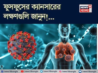 ফুসফুসের ক্যানসারের লক্ষণ কী কী, কাদের হওয়ার ভয় বেশি, জানুন! বলছেন বিশেষজ্ঞ চিকিৎসক