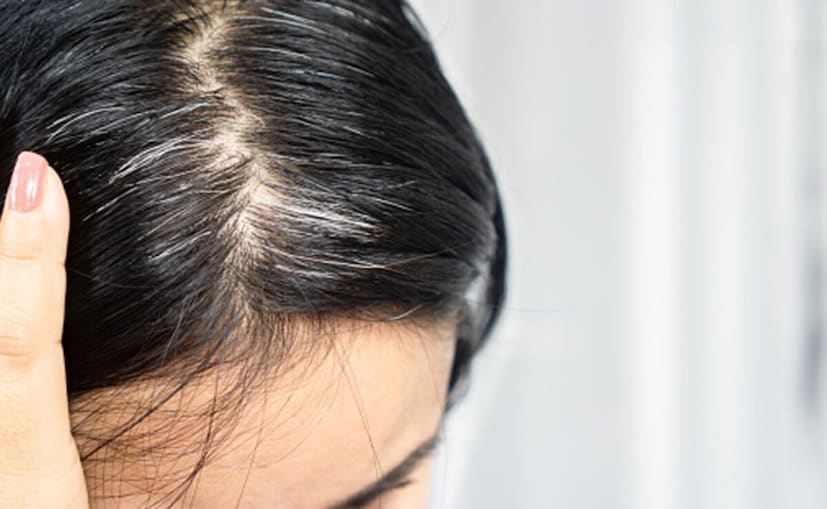 প্রাকৃতিক কালো চুলের রঙ তৈরি করতে আপনার ২ টেবিল চামচ মেহেন্দি গুঁড়ো, ১ টেবিল চামচ ভৃঙ্গরাজ গুঁড়ো, ১ চা চামচ নীল গুঁড়ো, ১ চা চামচ আমলকি গুঁড়ো এবং ১/২ কাপ হালকা গরম জল বা কালো চা লাগবে। সমস্ত গুঁড়ো একটি পেস্টে মিশিয়ে ৪-৫ ঘন্টা ঢেকে রেখে দিন। তারপর এই মিশ্রণ আপনার চুলের গোড়া থেকে আগা পর্যন্ত লাগিয়ে ২ ঘণ্টা রেখে দিন। সাধারণ জল দিয়ে ধুয়ে ফেলুন এবং শ্যাম্পু করা এড়িয়ে চলুন। সপ্তাহে একবার এটি ব্যবহার করুন।