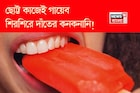 শীতের আগেই দাঁতের শিরশিরানি চরমে! ছোট্ট কাজেই গায়েব দাঁতের কনকনানি! রইল মুশকিল আসান টোটকা
