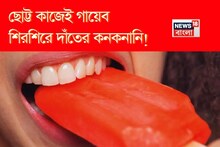 শীতের আগেই দাঁতের শিরশিরানি চরমে! ছোট্ট কাজেই গায়েব দাঁতের কনকনানি! রইল মুশকিল আসান টোটকা