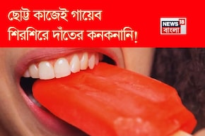 শীতের আগেই দাঁতের শিরশিরানি চরমে! ছোট্ট কাজেই গায়েব দাঁতের কনকনানি! রইল মুশকিল আসান টোটকা