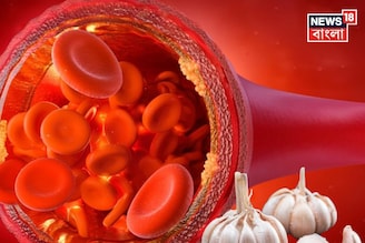 রসুন খেলেই নাকি হুড়মুড়িয়ে কমবে খারাপ কোলেস্টেরল! জব্দ হার্টের রোগ! থামুন খাওয়ার আগে!