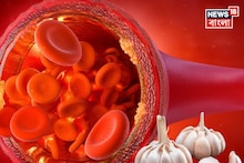 Garlic & Cholesterol: সকালে খালি পেটে রসুন খেলেই নাকি হুড়মুড়িয়ে কমবে খারাপ কোলেস্টেরল! জব্দ হার্টের রোগ! থামুন মুখে ফেলার আগে!