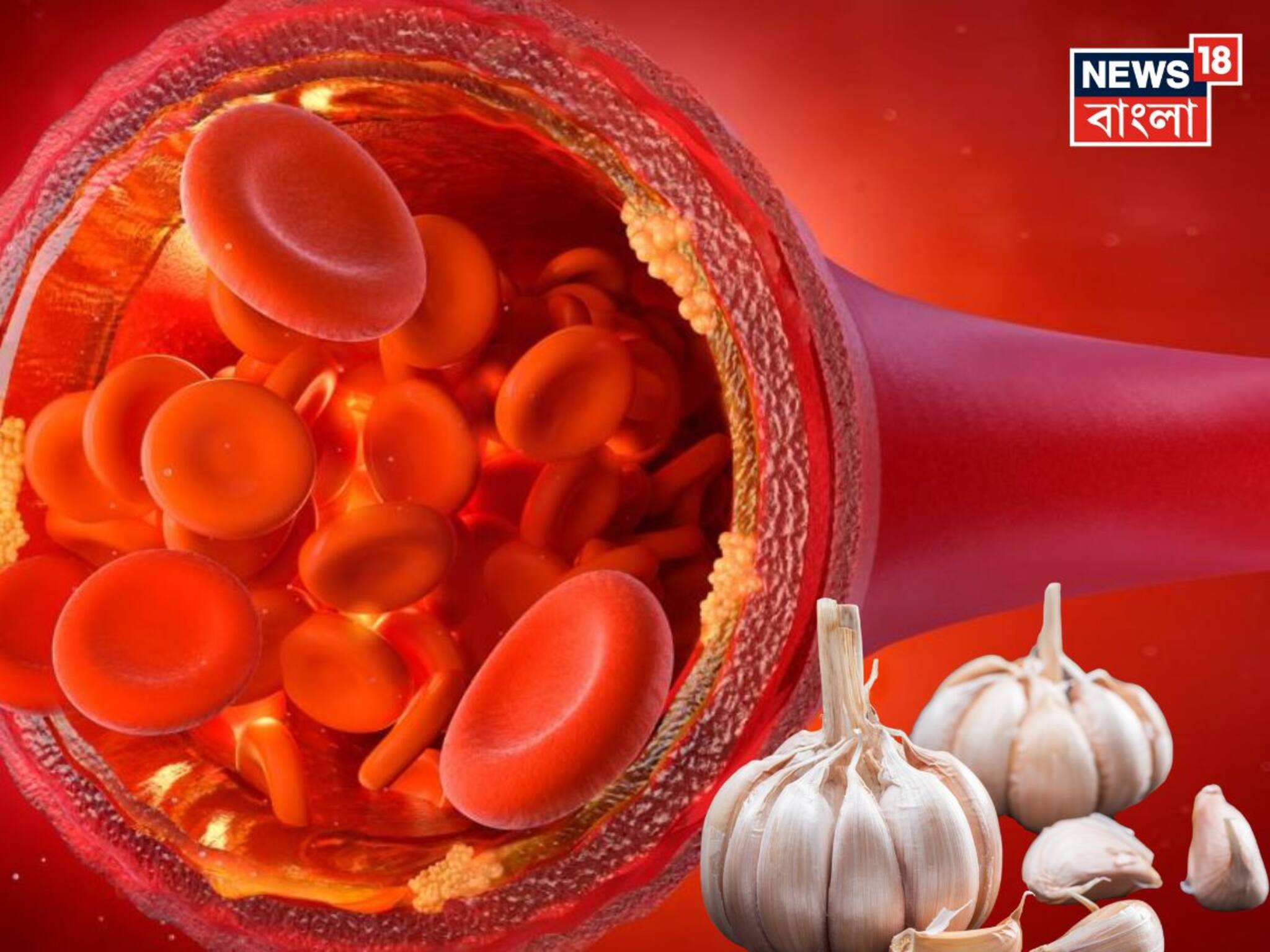 Garlic & Cholesterol: সকালে খালি পেটে রসুন খেলেই নাকি হুড়মুড়িয়ে কমবে খারাপ কোলেস্টেরল! জব্দ হার্টের রোগ! থামুন মুখে ফেলার আগে!
