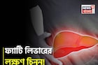 পচবে লিভার! হতে পারে ক্যানসারও! ভুঁড়ি, ক্লান্তি, পেটব্যথা...চিনুন ফ্যাটি লিভারের লক্ষণ!