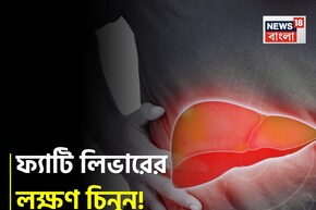 পচবে লিভার! হতে পারে ক্যানসারও! ভুঁড়ি, ক্লান্তি, পেটব্যথা...চিনুন ফ্যাটি লিভারের লক্ষণ!