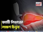 পচবে লিভার! হতে পারে ক্যানসারও! ভুঁড়ি, ক্লান্তি, পেটব্যথা...চিনুন ফ্যাটি লিভারের লক্ষণ!