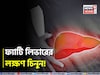 পচবে লিভার! হতে পারে ক্যানসারও! ভুঁড়ি, ক্লান্তি, পেটব্যথা...চিনুন ফ্যাটি লিভারের লক্ষণ!
