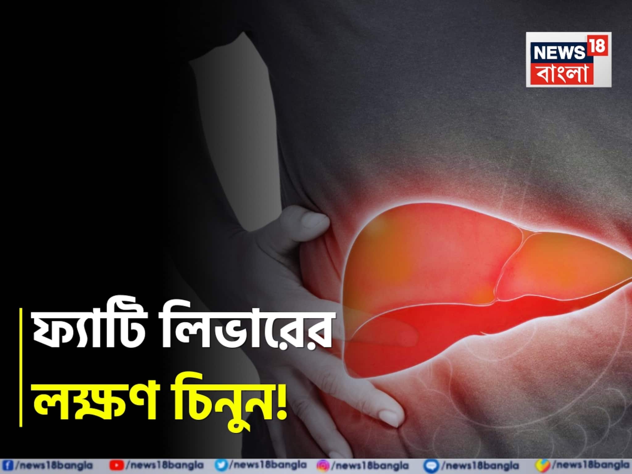 Fatty Liver Symptoms: ফ্যাট জমেই পচবে লিভার! হতে পারে ক্যানসারও! ভুঁড়ি, ক্লান্তি থেকে পেটব্যথা...জানুন ফ্যাটি লিভারের লক্ষণ!