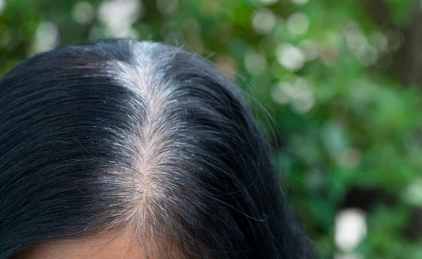 হলুদে কারকিউমিন থাকে, যা প্রাকৃতিকভাবে চুল কালো করতে সাহায্য করে। এটি চুল ভাঙা থেকে রক্ষা করে এবং খুশকি দূর করে, চুলকে সুস্থ ও শক্তিশালী করে।