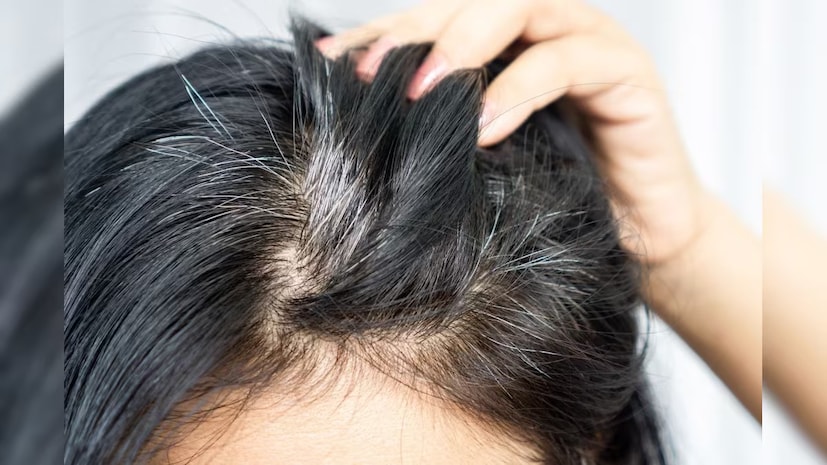 (Disclaimer: এই প্রতিবেদনটি কেবলমাত্র সাধারণ তথ্যের জন্য, তাই বিস্তারিত জানতে হলে সর্বদা বিশেষজ্ঞের পরামর্শ নিন।)(সব ছবি-নেটমাধ্যম)