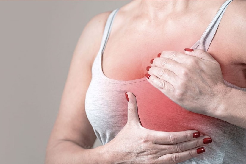 ডাঃ বিজয়শ্রী মূর্তি, সিনিয়র কনসালটেন্ট সার্জিক্যাল অঙ্কোলজি, এইচসিজি আইসিএস খুবচন্দানি, কোলাবা আপনার যা জানা দরকার তা শেয়ার করেছেন। কারণ অনেক মহিলারই কোনও পিণ্ড না থাকলেও স্তনবৃন্ত থেকে দুধ ছাড়া স্রাবের মতো লক্ষণ দেখা দিতে পারে, বিশেষ করে যদি এটি স্বতঃস্ফূর্ত বা স্থায়ী হয়। সাম্প্রতিক স্তনবৃন্ত ভিতরে ঢুকে যাওয়ার মতো অন্যান্য লক্ষণগুলির মধ্যে রয়েছে একটি পিণ্ড যা হঠাৎ করে কোনও স্পষ্ট ব্যাখ্যা ছাড়াই ভিতরের দিকে ঢুকে যেতে শুরু করে।