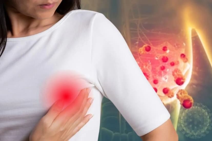 স্তন ক্যানসারের প্রাথমিক শনাক্তকরণের ক্ষেত্রে, প্রায়ই শারীরিক পরিবর্তনগুলি স্পষ্ট হওয়ার আগেই, সবচেয়ে গুরুত্বপূর্ণ হাতিয়ারগুলির মধ্যে একটি হল স্ক্রিনিং ম্যামোগ্রাফি। ম্যামোগ্রামগুলি প্রাথমিকভাবে স্থাপত্যের বিকৃতি বা সন্দেহজনক ক্যালসিফিকেশনগুলি স্পষ্ট হওয়ার আগেই দেখা যেতে পারে। এই ধরনের ক্যানসারের ফলাফল নাটকীয়ভাবে উন্নত হয়, কম আক্রমণাত্মক চিকিৎসার প্রয়োজন হয়।