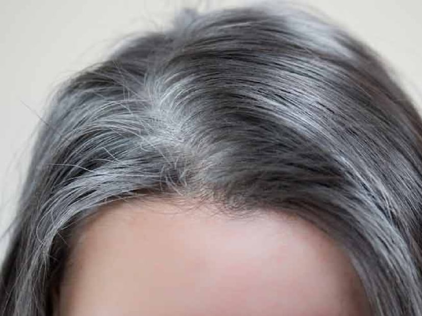 *এই প্রতিকার ব্যবহার করলে কয়েকদিনের মধ্যেই, আপনার গ্রে হেয়ার কোনও পার্শ্বপ্রতিক্রিয়া ছাড়াই ঘন, কালো চুলে পরিণত হবে। (এই নিবন্ধে প্রদত্ত তথ্য স্বাস্থ্য পরামর্শ এবং বিশেষজ্ঞদের সঙ্গে আলোচনার উপর ভিত্তি করে। এটি কেবল সাধারণ তথ্য, ব্যক্তিগত পরামর্শ নয়। অতএব, কোনও পদক্ষেপ নেওয়ার আগে দয়া করে একজন বিশেষজ্ঞের সঙ্গে পরামর্শ করুন।) সংগৃহীত ছবি।