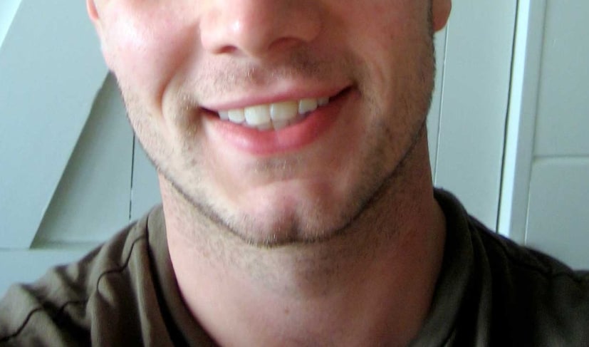 তবে, এটা জানা গুরুত্বপূর্ণ যে ফাটা চিবুক সাধারণ, যা প্রায় ১০০ জনের মধ্যে ১ জনকে প্রভাবিত করে। ইভোলিউশন অ্যান্ড হিউম্যান বিহেভিয়ার জার্নালে প্রকাশিত একটি গবেষণায় দেখা গিয়েছে যে ফাটা চিবুক যাদের রয়েছে তাদের ঝুঁকিপূর্ণ আচরণে জড়িত হওয়ার সম্ভাবনা বেশি। পার্সোনালিটি অ্যান্ড ইন্ডিভিজুয়াল ডিফারেন্সেস জার্নালে প্রকাশিত আরেকটি গবেষণায় দেখা গেছে যে ফাটা চিবুকযুক্ত ব্যক্তিরা দৃঢ়, আত্মবিশ্বাসী এবং সামাজিক হন, এমনই সম্ভাবনা। এখানে আমরা ফাটা চিবুকযুক্ত ব্যক্তিদের পারসোনালিটি বিবরণ করা হবে৷ 