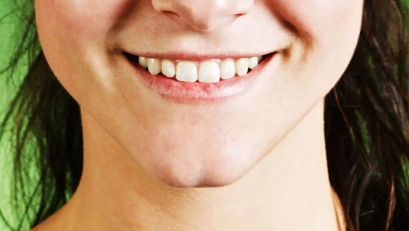 যদি আপনার চিবুক ফাটা থাকে, তাহলে আপনি অত্যন্ত ক্যারিশম্যাটিক, আত্মবিশ্বাসী, সামাজিক, বুদ্ধিমান, সৃজনশীল এবং শৈল্পিক হতে পারেন। আপনার নেতৃত্ব এবং ঝুঁকি নেওয়ার গুণাবলীও বেশি হতে পারে।