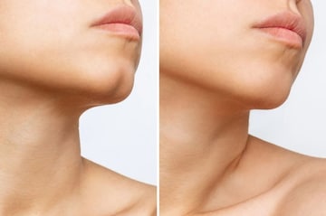 লোক চিনবেন থুতনি দেখে, এক নজরে বুঝে যাবেন সামনের মানুষের চরিত্র, সহজ টিপস রইল লোক চিনবেন থুতনি দেখে, এক নজরে বুঝে যাবেন সামনের মানুষের চরিত্র, সহজ টিপস রইল