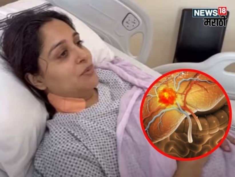 জনপ্রিয় টিভি অভিনেত্রী দীপিকা কাকর ইব্রাহিম, যাকে দর্শকরা 