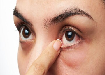 দৃষ্টিশক্তি রক্ষায় চিকিৎসকদের পরামর্শ অনুযায়ী কিছু সহজ পদক্ষেপ নিন