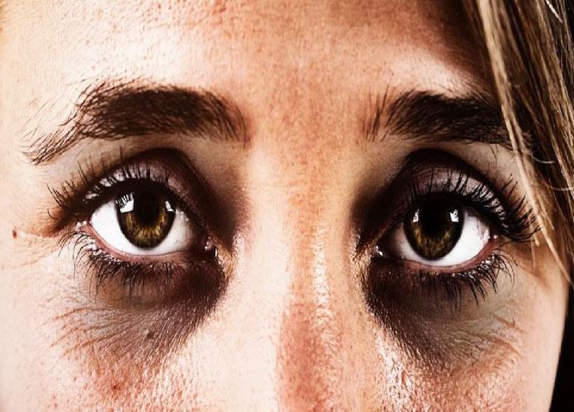 বিশেষজ্ঞদের মতে, উচ্চ রক্তচাপ, উচ্চ কোলেস্টেরল, টাইপ ২ ডায়াবেটিস, ধূমপানের অভ্যাস বা পরিবারে হৃদরোগের ইতিহাস থাকলে সতর্ক থাকা জরুরি। বয়স ৪০-এর বেশি হলে নিয়মিত চোখ পরীক্ষা করা উচিত। চোখের রেটিনা পরীক্ষা বা OCT স্ক্যানের মাধ্যমে চিকিৎসক হার্ট ও রক্তচাপ সংক্রান্ত ঝুঁকিও আন্দাজ করতে পারেন।