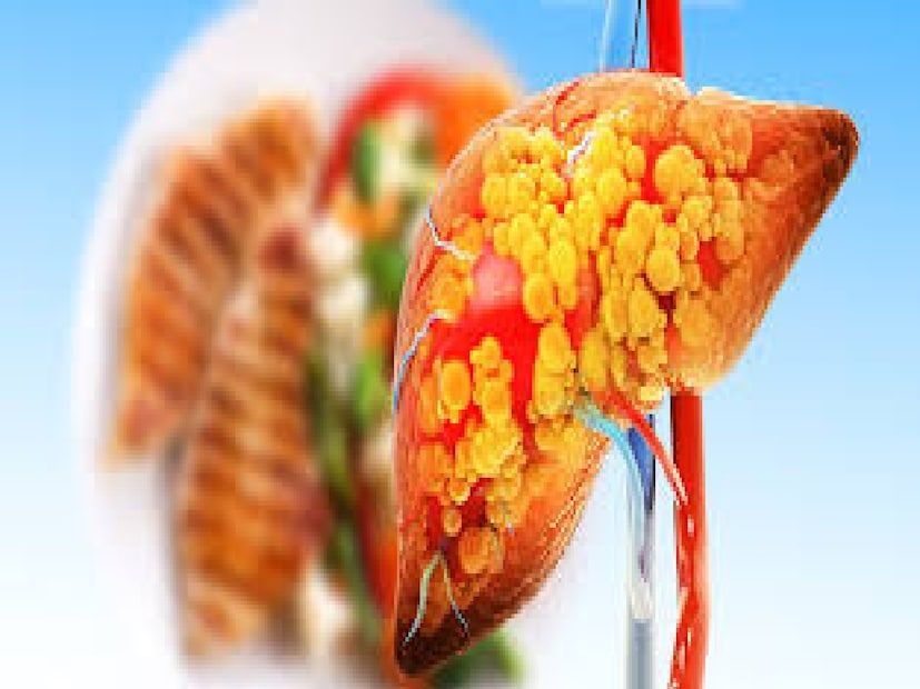 কিন্তু অনিয়মিত জীবনযাপন, খাবারের ভুল অভ্যাস, মানসিক চাপ—এসবই যকৃতের উপর বাড়তি চাপ ফেলে। আয়ুর্বেদ মতে, যকৃতই পিত্ত দোষের আসন। তাই পিত্তের ভারসাম্য নষ্ট হলে দেখা দেয় ত্বকের প্রদাহ, ব্রণ, সোরাইসিস, কোল্ড সোর, হজমের সমস্যা ও শরীরে টক্সিন জমে যাওয়ার ফলে নানা অসুবিধা। দীর্ঘদিন ভারসাম্যহীন থাকলে তৈরি হতে পারে হেপাটাইটিস, জন্ডিস, সিরোসিস, এমনকি ক্যানসারের মতো বড় রোগও।