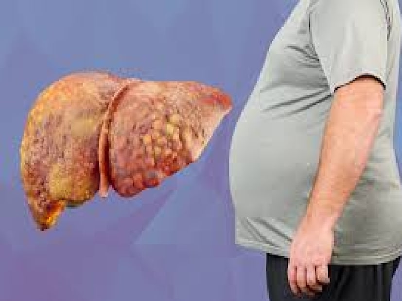 স্টাডি কী বলছে?“Comparing effects of beetroot juice…” শীর্ষক গবেষণায় দেখা গেছে— প্রতিদিন ২৫০ mL বিটরুট জুস ১২ সপ্তাহ খেলেই লিভার এনজাইম ALT ও ALP কমে ফ্যাটি লিভারের উন্নতি হয় কোলেস্টেরল, ট্রাইগ্লিসারাইড কমে