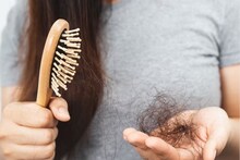 Hair Care Tips: মাথায় টাক পড়ে যাচ্ছে! চুল পড়া বন্ধ হবে, ২ সপ্তাহেই গজাবে নতুন চুল ! ১ টাকাও খরচ হবে না...! জানুন লাগানোর সঠিক নিয়ম