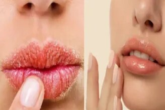 শীত পড়ার আগেই ঠোঁট ফেটে যাচ্ছে? নরম গোলাপি ঠোঁট পেতে জেনে নিন ঘরোয়া সহজ উপায়